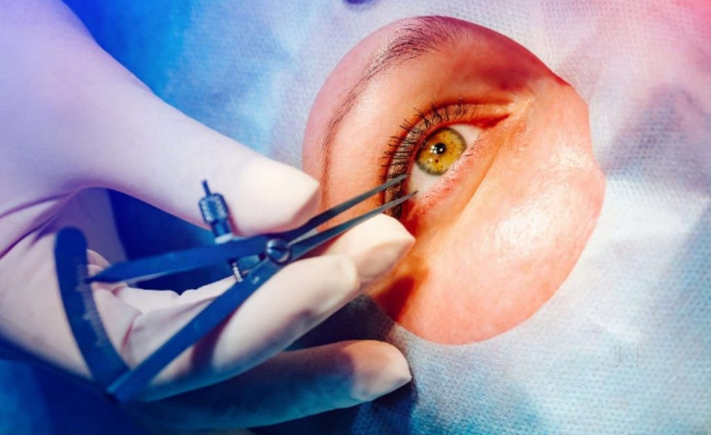 Injeção Intravítrea com Eylia (Aflibercepte): Tratamento Avançado para Doenças da Retina