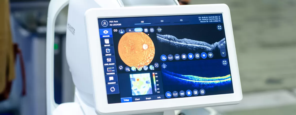 Tomografia de Coerência Óptica (OCT): O Guia Completo para a Saúde dos Seus Olhos